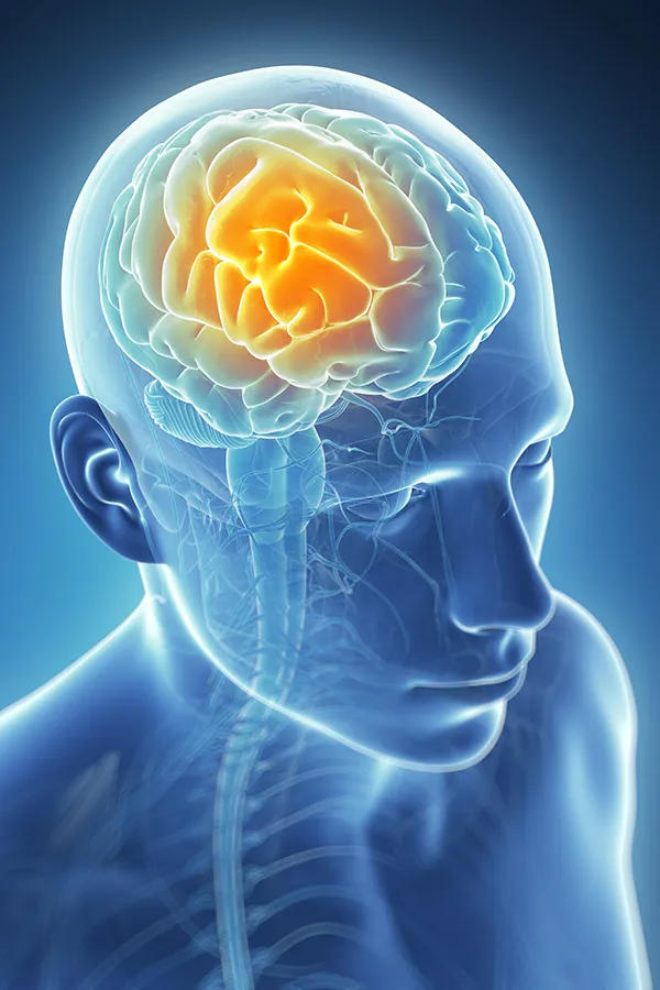 Migraine-Treatment 3D illustration of the brain with glowing pain center. Fonthealth treats migraines using functional medicine in Niagara.