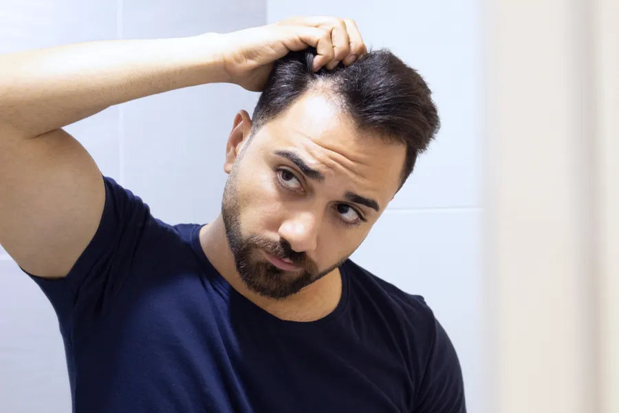 PRP-for-Hair-Loss-Doctor A man in a navy t-shirt looks in the mirror worrying about and touching his receding hairline, considering PRP for hair loss and restoration treatment from Fonthealth in Niagara.